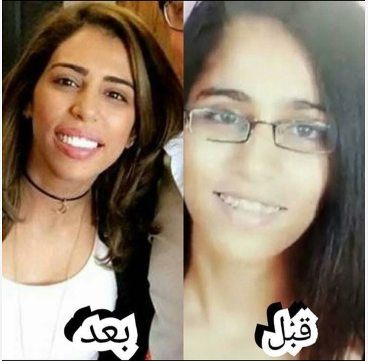 فنانات مغربيات قبل و بعد الشهرة