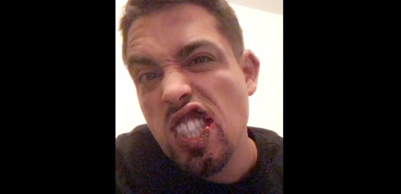 فيديو.. »لارتيست » يتعرض لاعتداء خطير أمام منزله