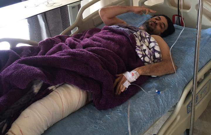 بعد العملية الجراحية.. هشام بهلول يطمئن جمهوره