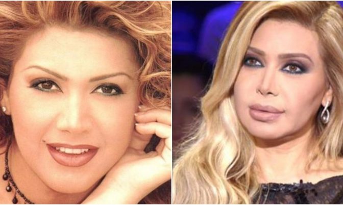 نوال الزغبي نادمة وتؤكد لأول مرة حقيقة خضوعها التجميل (فيديو)