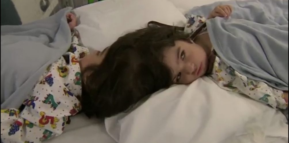 استغرقت العملية 50 ساعة.. أطباء ينجحون في فصل توأم ملتصق! (فيديو)