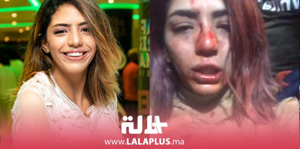 الصخيرات.. مغنية الراب &laquo;&nbsp;بسيكو كوين&nbsp;&raquo; تتعرض لاعتداء من مجهول (فيديو)