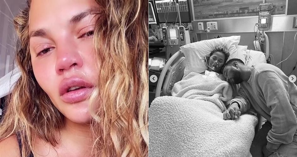 بحزن كبير.. النجمة الأمريكية كريسي تايغن تعلن عدم قدرتها على الحمل مجددا (صورة)