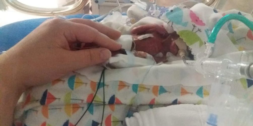 ولد في الشهر الخامس.. نجاة أصغر طفل في العالم