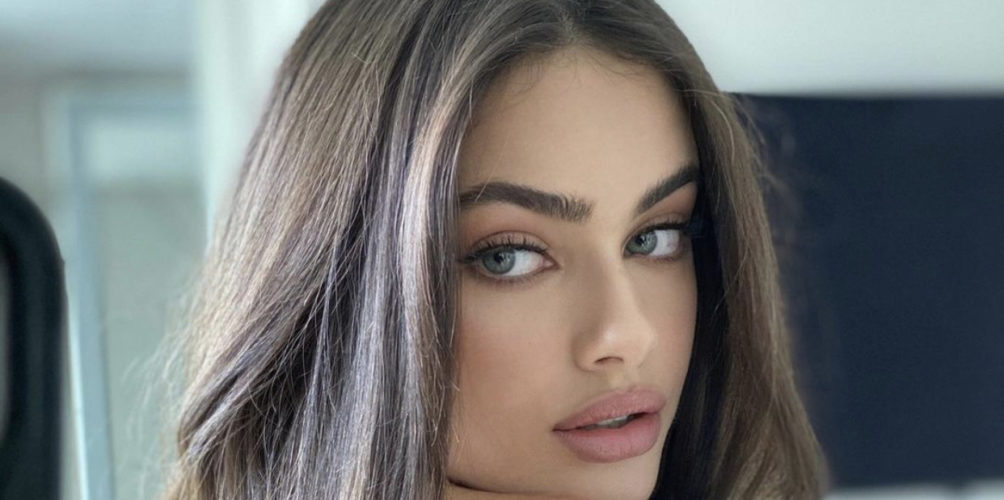 لم يسلم منه أحد.. صاحبة أجمل وجه في العالم تكشف تعرضها للتنمر