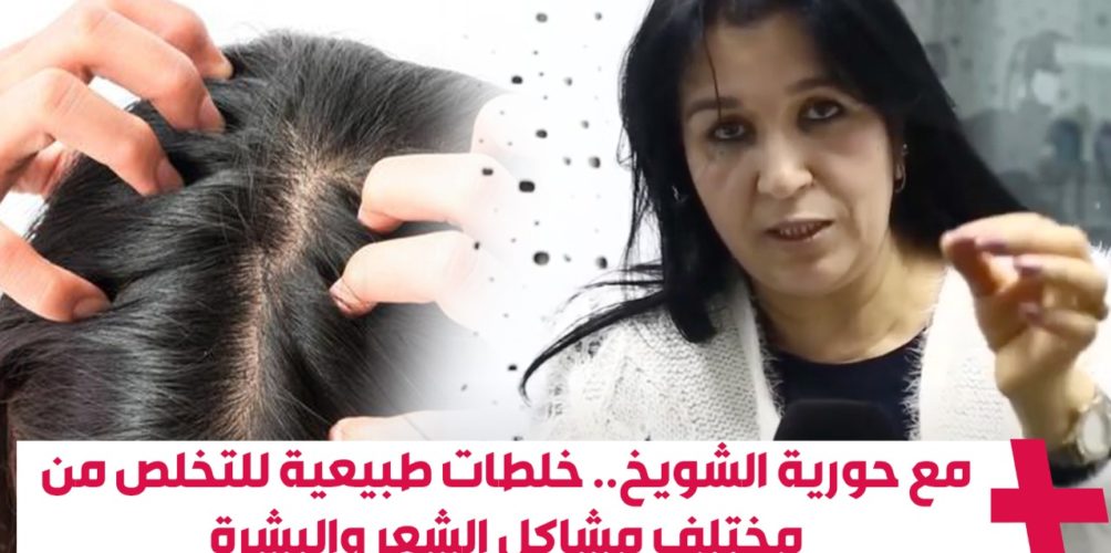 مع حورية الشويخ.. خلطات طبيعية للتخلص من مختلف مشاكل الشعر والبشرة (فيديو)