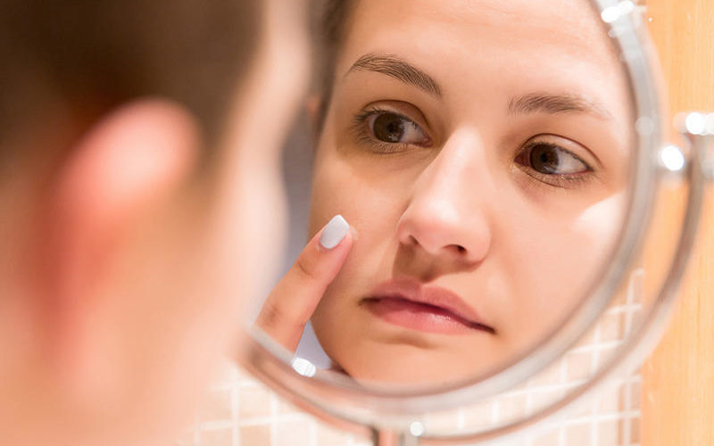 طبيبة: الزنك يعد سلاحا فعالا لمحاربة البثور