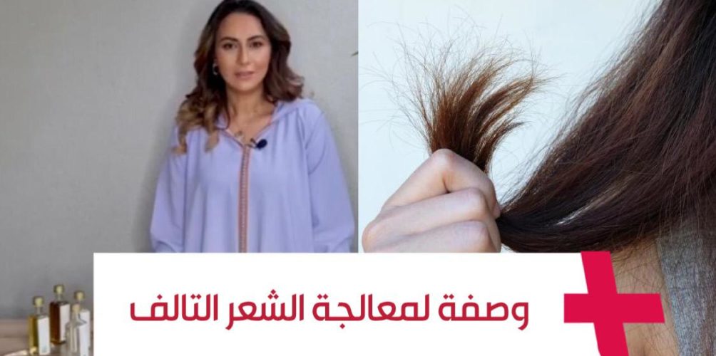 لمعالجة الشعر التالف.. وصفة طبيعية بمكونات بسيطة (فيديو)