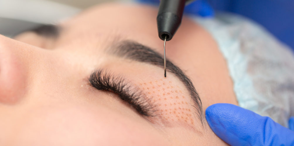 رغم أهميتها لتجميل الوجه.. أطباء يكشفون مضاعفات عملية شد الجفون