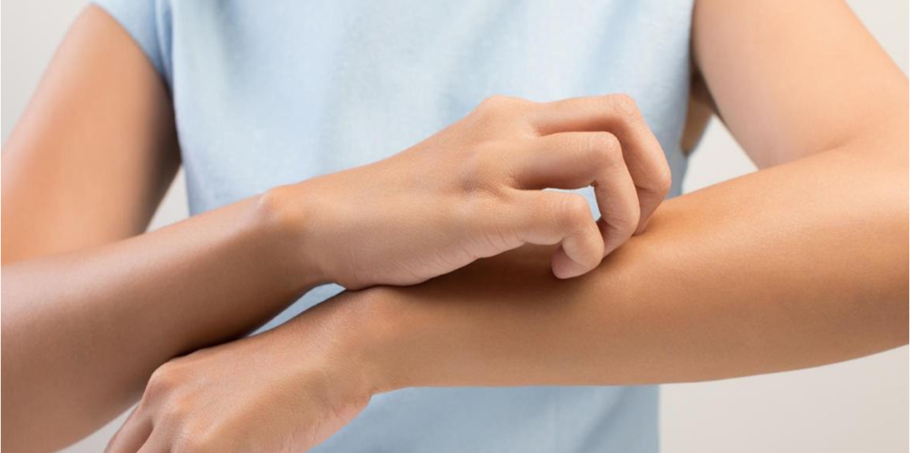 قد تنذر بالإصابة بالسرطان.. أسباب الحكة