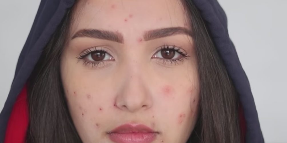 (بسبب التنمر.. هند الزيادي تطلق أغنية&nbsp;&raquo;زطم&nbsp;&raquo; (فيديو